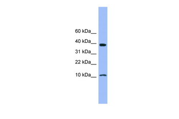 CSTB Rabbit Polyclonal Antibody