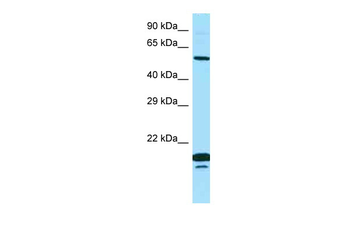 SPINT1 Rabbit Polyclonal Antibody