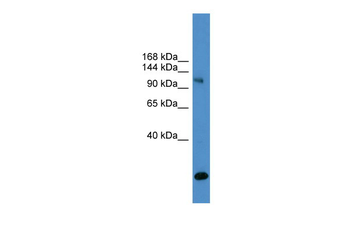 USP8 Rabbit Polyclonal Antibody