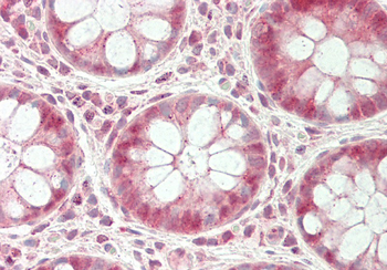 UCHL3 Rabbit Polyclonal Antibody