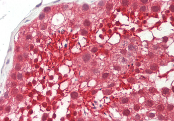 UCHL3 Rabbit Polyclonal Antibody