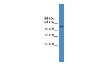 USP38 Rabbit Polyclonal Antibody