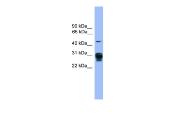 PSMD9 Rabbit Polyclonal Antibody