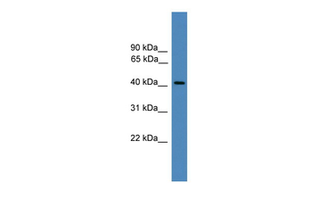 PSMC6 Rabbit Polyclonal Antibody