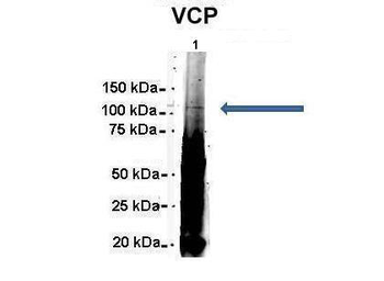 VCP Rabbit Polyclonal Antibody