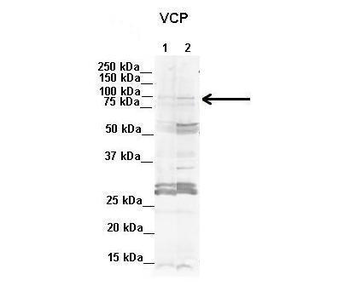 VCP Rabbit Polyclonal Antibody