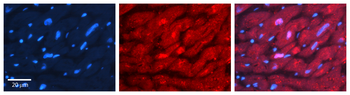 VCP Rabbit Polyclonal Antibody