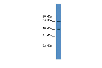 UBL7 Rabbit Polyclonal Antibody