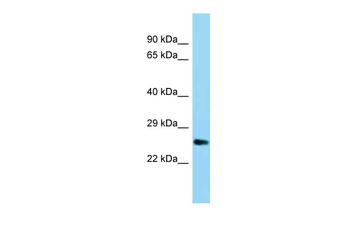 Ubtd1 Rabbit Polyclonal Antibody