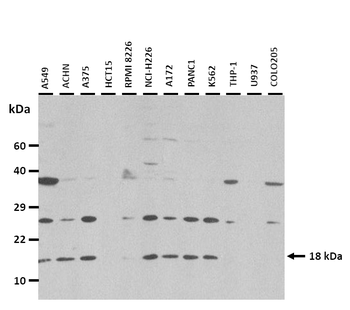 RPS27A Rabbit Polyclonal Antibody