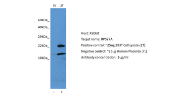 RPS27A Rabbit Polyclonal Antibody