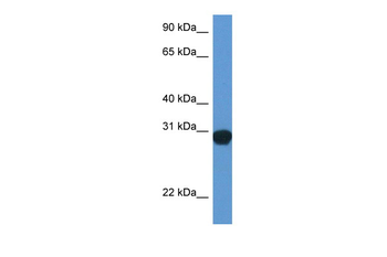 Snap29 Rabbit Polyclonal Antibody