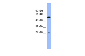 COCH Rabbit Polyclonal Antibody
