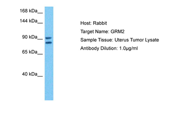 GRM2 Rabbit Polyclonal Antibody