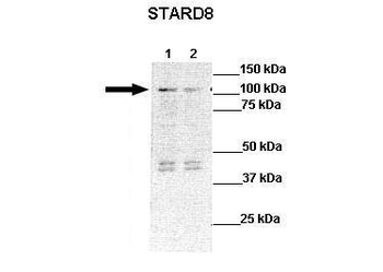 STARD8 Rabbit Polyclonal Antibody