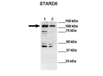 STARD8 Rabbit Polyclonal Antibody