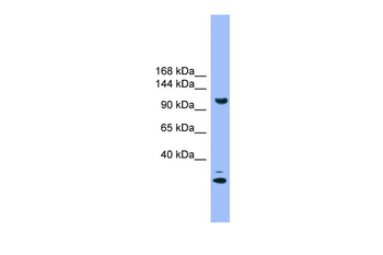 STARD8 Rabbit Polyclonal Antibody
