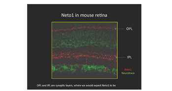 NETO1 Rabbit Polyclonal Antibody