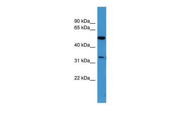 CERKL Rabbit Polyclonal Antibody