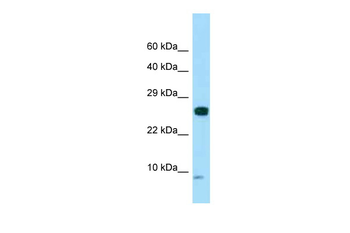 SPANXC Rabbit Polyclonal Antibody