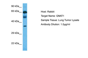 GNAT1 Rabbit Polyclonal Antibody
