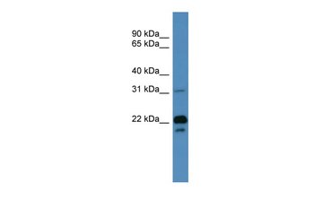 BASP1 Rabbit Polyclonal Antibody