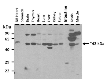 Aplnr Rabbit Polyclonal Antibody