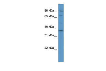FGFR2 Rabbit Polyclonal Antibody