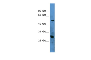 C1QA Rabbit Polyclonal Antibody