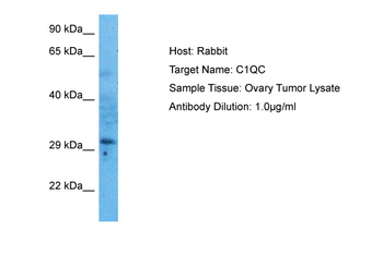 C1QC Rabbit Polyclonal Antibody