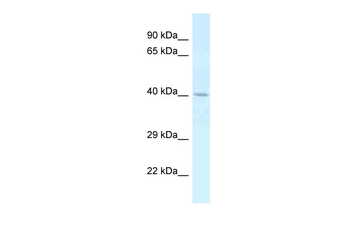 CTSE Rabbit Polyclonal Antibody