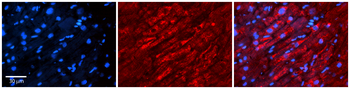 CYP2J2 Rabbit Polyclonal Antibody
