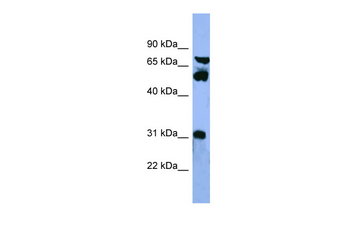 CYP8B1 Rabbit Polyclonal Antibody