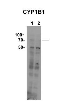 CYP11B1 Rabbit Polyclonal Antibody