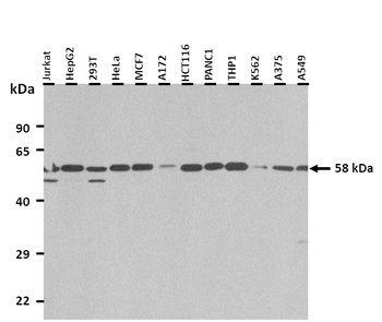 CYP11B1 Rabbit Polyclonal Antibody