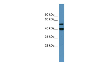 DDB2 Rabbit Polyclonal Antibody