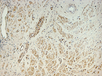 AKR1C1 Rabbit Polyclonal Antibody