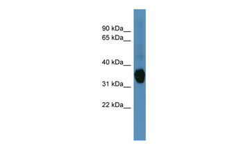 AKR1C1 Rabbit Polyclonal Antibody