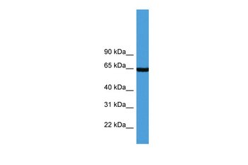 ASNS Rabbit Polyclonal Antibody