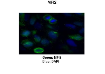 MELTF Rabbit Polyclonal Antibody