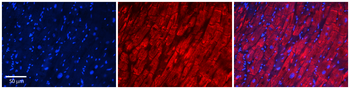 ST5 Rabbit Polyclonal Antibody