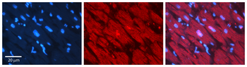 ST5 Rabbit Polyclonal Antibody