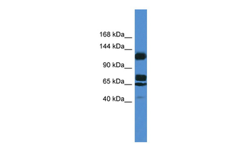 ST5 Rabbit Polyclonal Antibody