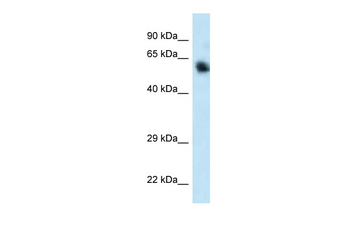 CAMKK1 Rabbit Polyclonal Antibody