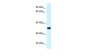 SLC25A33 Rabbit Polyclonal Antibody