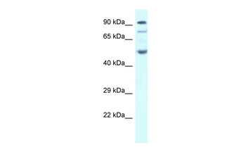 SESN2 Rabbit Polyclonal Antibody