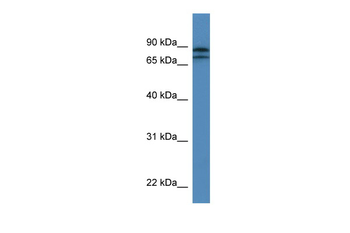 KLHL22 Rabbit Polyclonal Antibody