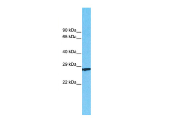 CD63 Rabbit Polyclonal Antibody