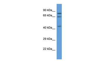 ACOX3 Rabbit Polyclonal Antibody