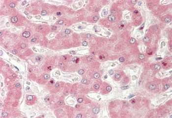 ADIPOR2 Rabbit Polyclonal Antibody